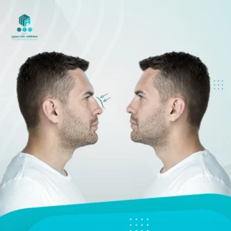 أخر مراحل تغير الأنف بعد التجميل