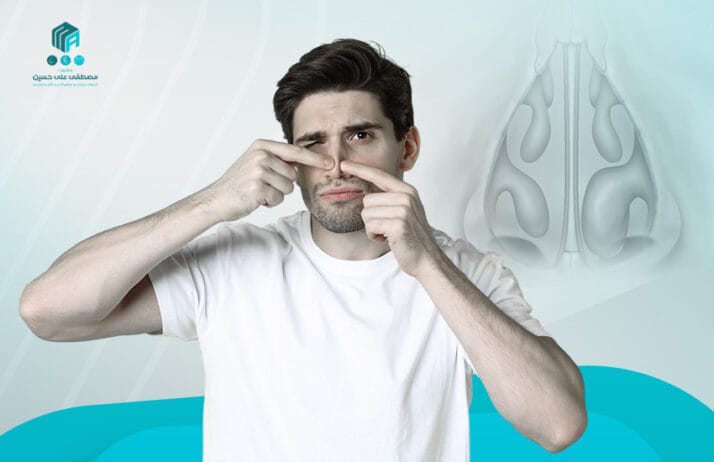 تصغير قرنيات الانف