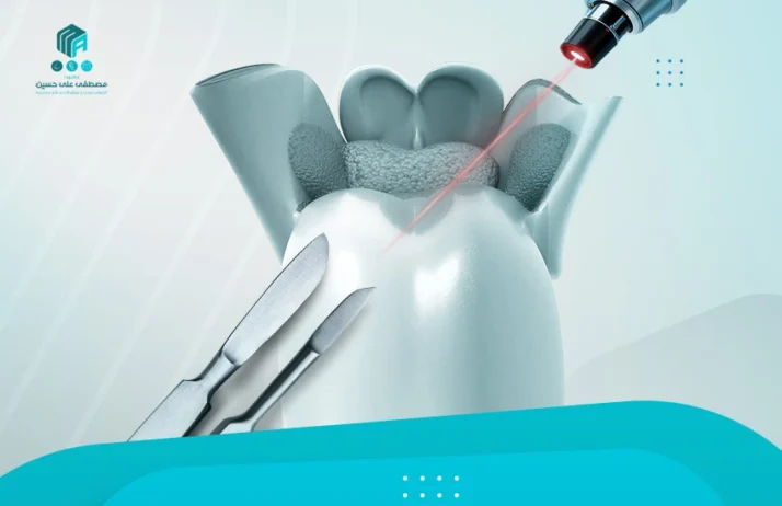 الفرق بين عملية اللوز بالليزر والجراحة